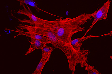 Imagen de una célula madre observada en el laboratorio. (Foto suministrada)